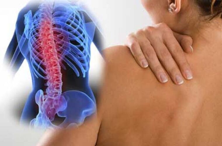 Con l'osteocondrosi, il dolore può irradiarsi in aree distanti del corpo
