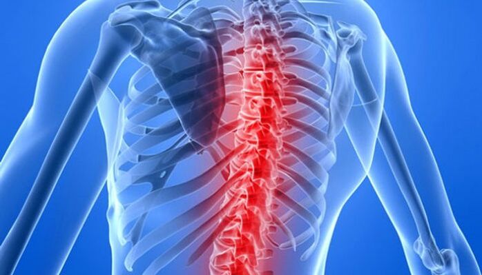Le patologie spinali sono la causa più comune di mal di schiena nella zona della scapola