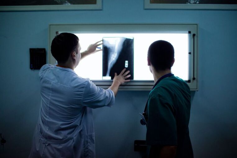 Diagnosi di osteoartrosi sui raggi X