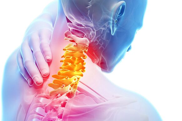 Osteocondrosi cervicale