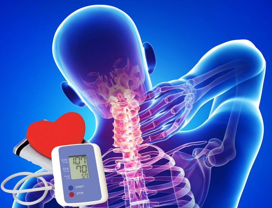 Salti della pressione sanguigna nell'osteocondrosi cervicale