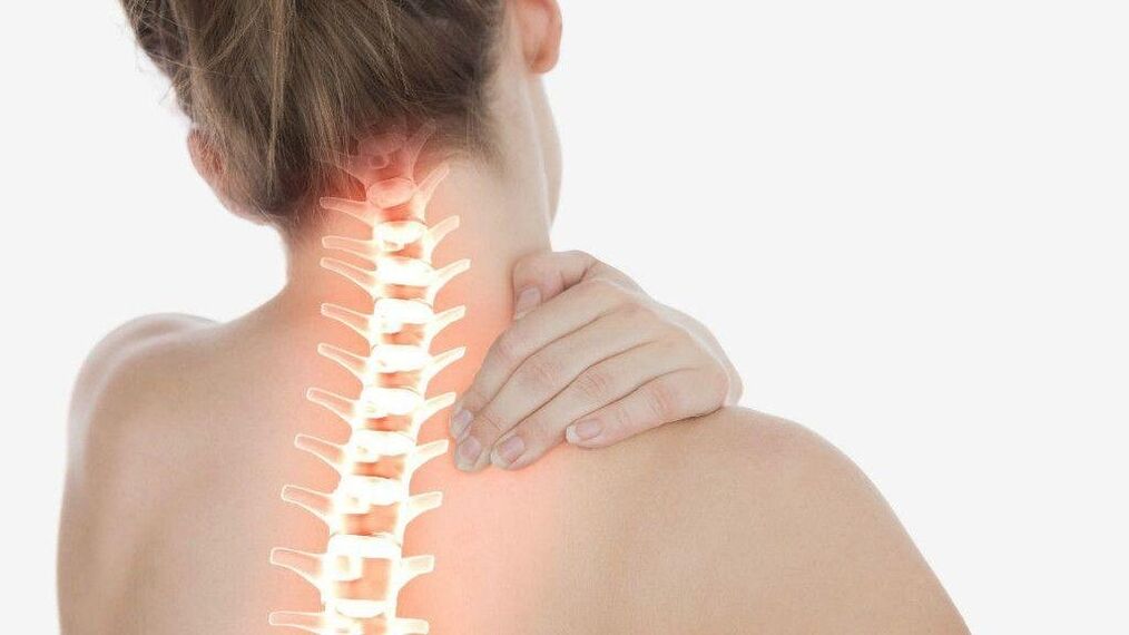La sindrome radicolare può svilupparsi con l'osteocondrosi del rachide cervicale