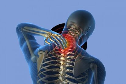 Dolore al collo con osteocondrosi